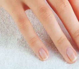 Techniques to get rid of whiteheads on nails?