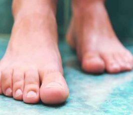 Treatment of toenail fungus or onychomycosis