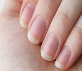 How to have beautiful nails when you bite them?