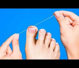 Ingrown toenail treatment: The trick of dental floss