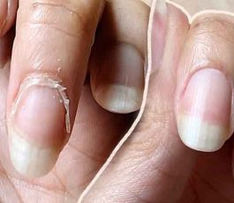 Cuticles: should they be cut or pushed back?